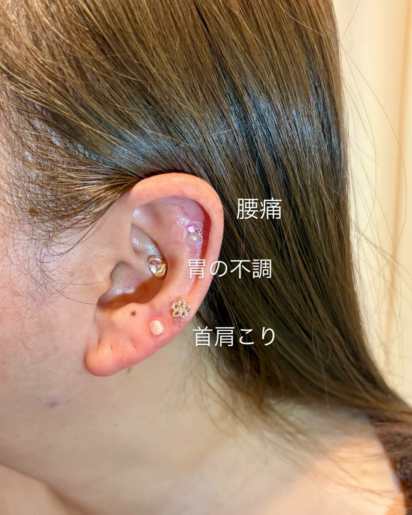 【耳ツボ✖︎美容鍼】